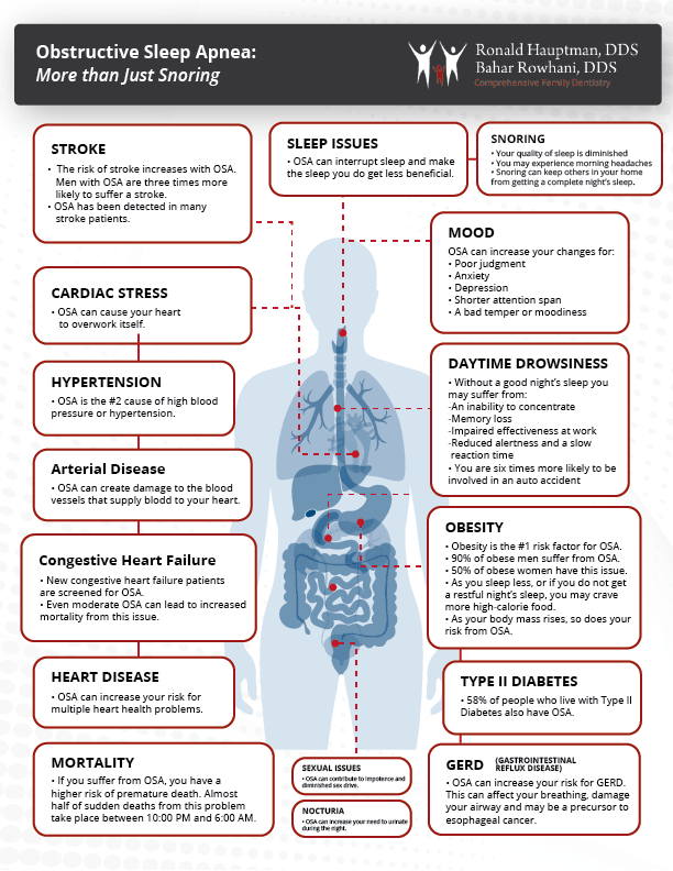 Infographic